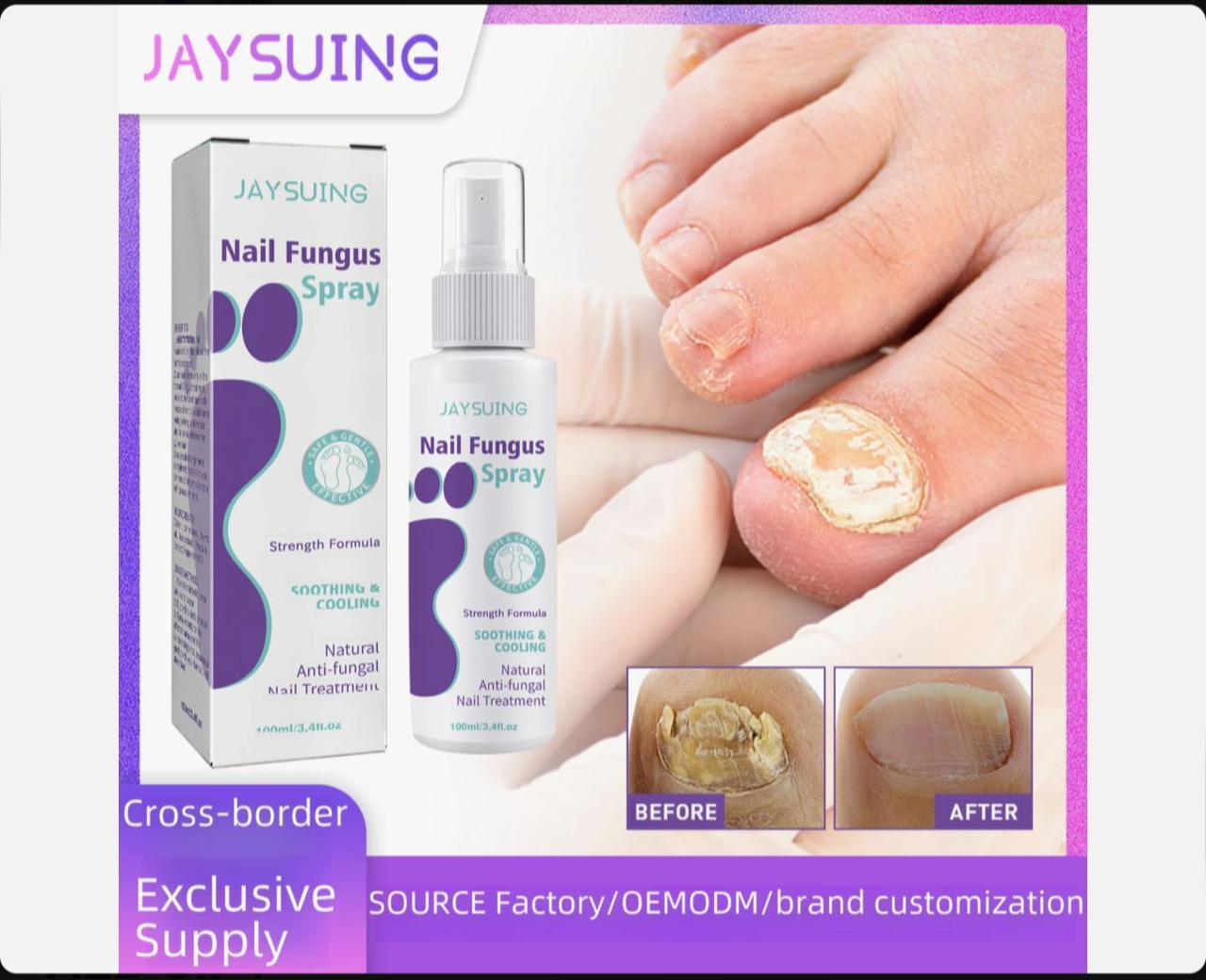 Jaysuing Nail Fungus Spray
