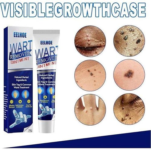 Eelhoe Wart Remover Ointment with natural herbal ingredients, effective for skin tag and warts treatment