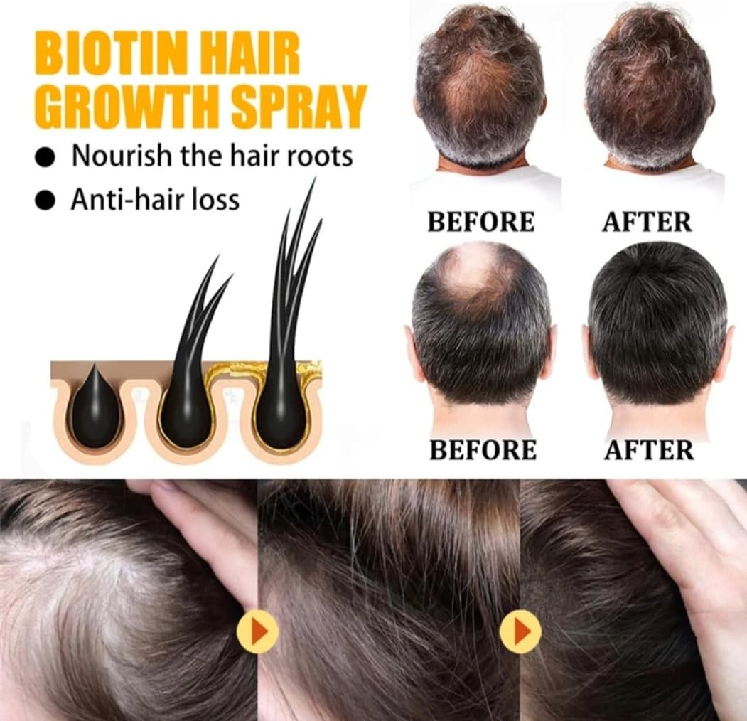 Biotin hair growth spray benefits with before and after photos showing reduced hair loss and fuller hair roots