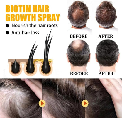 Biotin hair growth spray benefits with before and after photos showing reduced hair loss and fuller hair roots
