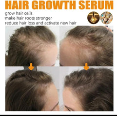 Before and after photos showing hair growth serum results on thinning hair with improved scalp coverage