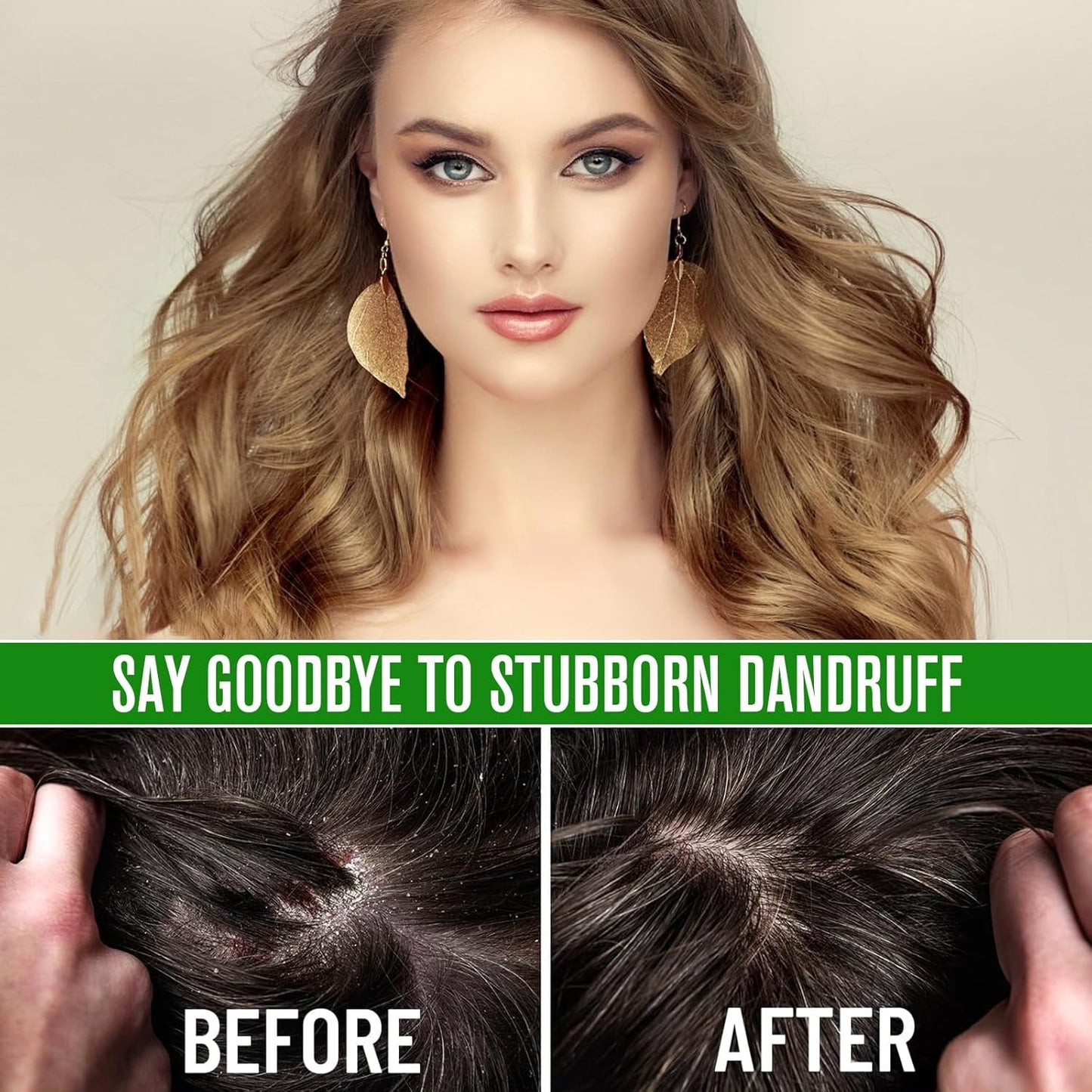 Before and after dandruff treatment close-up and woman with long blonde hair and gold leaf earrings
