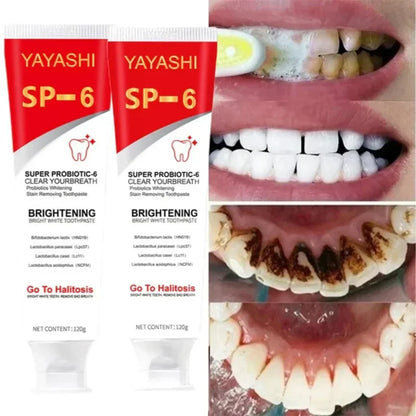 YAYASHI SP-6 Ultra Whitening Toothpaste