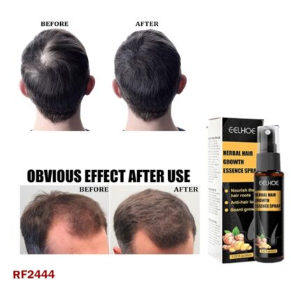 Before and after images showing hair growth improvement using Eelhoe Herbal Hair Growth Essence Spray with visible thicker hair