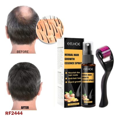 Before and after hair growth results using EELHOE herbal hair growth essence spray and derma roller for hair and beard nourishment