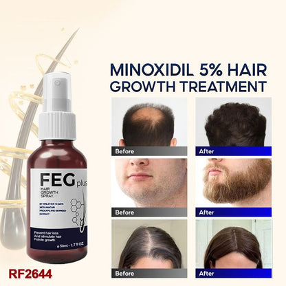 FEG plus Minoxidil 5% hair growth spray with before and after photos showing improved scalp, beard, and hair density