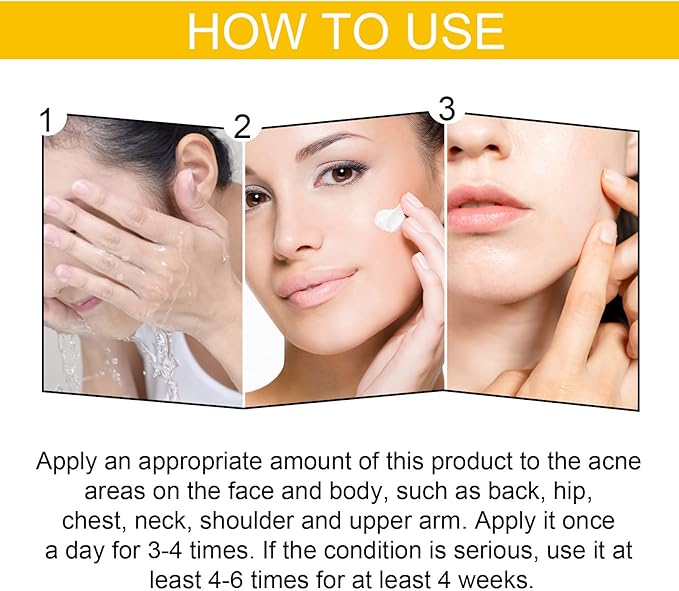Step-by-step acne cream application for face cleansing, moisturizing, and targeted treatment on skin