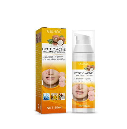 Eelhoe cystic acne treatment cream 30ml with before and after skin images on orange packaging
